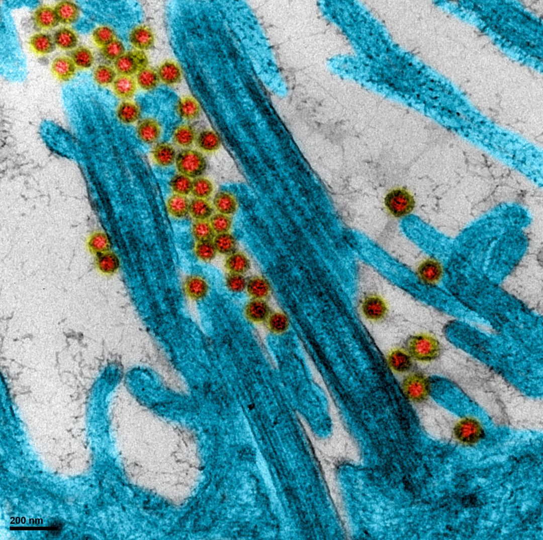 Coronavirus-COVID-19-SARS-CoV-2-microscope